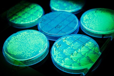 Green Florescent Protein (GFP) being expressed in  a strain of  E.coli  in L.B. agar medium .The plate in the center is the control that is not expressing any GFP.